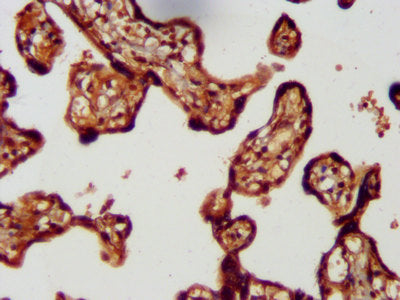 IHC image of LMCD1 Antibody diluted at 1:300 and staining in paraffin-embedded human placenta tissue performed on a Leica BondTM system. After dewaxing and hydration, antigen retrieval was mediated by high pressure in a citrate buffer (pH 6.0). Section was blocked with 10% normal goat serum 30min at RT. Then primary antibody (1% BSA) was incubated at 4°C overnight. The primary is detected by a biotinylated secondary antibody and visualized using an HRP conjugated SP system.