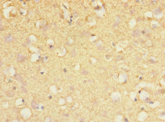 Immunohistochemistry of paraffin-embedded human brain tissue using MARK1 Antibody at dilution of 1:100