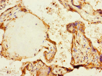 Immunohistochemistry of paraffin-embedded human placenta tissue using MARK1 Antibody at dilution of 1:100