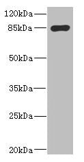 Western blot | All lanes: MARK1 antibody IgG at 2.65μg/ml + Rat heart tissue | Secondary | Goat polyclonal to rabbit IgG at 1/10000 dilution | Predicted band size: 90, 73, 85 kDa | Observed band size: 90 kDa