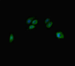 Immunofluorescent analysis of HepG2 cells using TBC1D7 Antibody at dilution of 1:100 and Alexa Fluor 488-congugated AffiniPure Goat Anti-Rabbit IgG(H+L)Rabbit anti-Human TBC1D7 Polyclonal Antibody