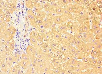 Immunohistochemistry of paraffin-embedded human liver tissue using the antibody at dilution of 1:100Rabbit anti-Human TBC1D7 Polyclonal Antibody