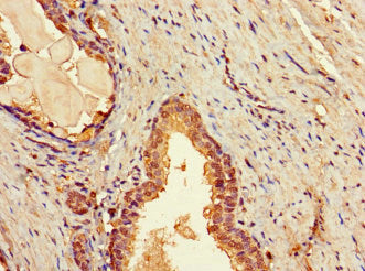 Immunohistochemistry of paraffin-embedded human prostate tissue using TBC1D7 Antibody at dilution of 1:100Rabbit anti-Human TBC1D7 Polyclonal Antibody