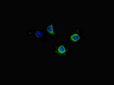 Immunofluorescent analysis of Hela cells using PIM2 Antibody at dilution of 1:100 and Alexa Fluor 488-congugated AffiniPure Goat Anti-Rabbit IgG(H+L)Rabbit anti-Human PIM2 Polyclonal Antibody
