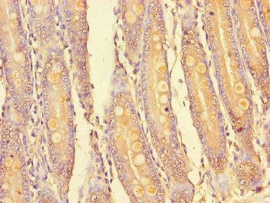 Immunohistochemistry of paraffin-embedded human small intestine tissue using the antibody at dilution of 1:100Rabbit anti-Human PIM2 Polyclonal Antibody