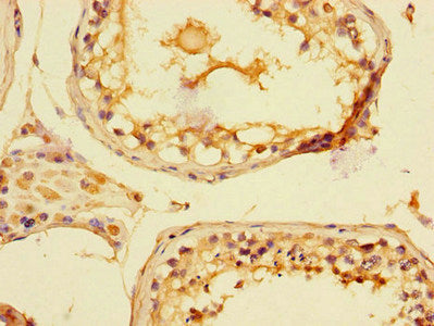 Immunohistochemistry of paraffin-embedded human testis tissue using PIM2 Antibody at dilution of 1:100Rabbit anti-Human PIM2 Polyclonal Antibody