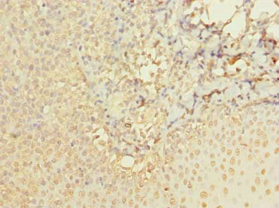 Immunohistochemistry of paraffin-embedded human tonsil tissue using ABI3 Antibody at dilution of 1:100