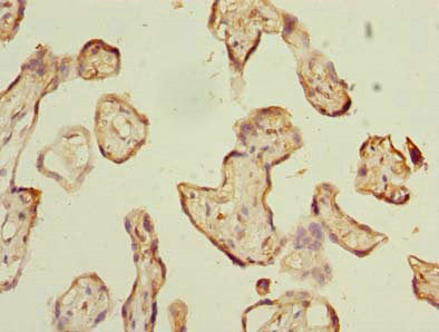 Immunohistochemistry of paraffin-embedded human placenta tissue using ABI3 Antibody at dilution of 1:100