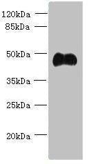 Western blot | All lanes: ABI3 antibody at 5μg/ml + Mouse heart tissue | Secondary | Goat polyclonal to rabbit IgG at 1/10000 dilution | Predicted band size: 40, 39 kDa | Observed band size: 40 kDa