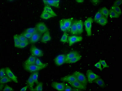Immunofluorescence staining of HepG2 cells with LARS Antibody at 1:100, counter-stained with DAPI. The cells were fixed in 4% formaldehyde, permeabilized using 0.2% Triton X-100 and blocked in 10% normal Goat Serum. The cells were then incubated with the antibody overnight at 4°C. The secondary antibody was Alexa Fluor 488-congugated AffiniPure Goat Anti-Rabbit IgG(H+L).