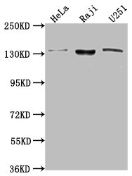 Western Blot | Positive WB detected in: Hela whole cell lysate, Raji whole cell lysate, U251 whole cell lysate | All lanes: LARS antibody at 1:2000 | Secondary | Goat polyclonal to rabbit IgG at 1/50000 dilution | Predicted band size: 135, 129, 56 kDa | Observed band size: 135 kDa