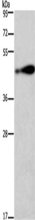 Gel: 10%SDS-PAGE, Lysate: 40 μg, Lane: 231 cells, Primary antibody: AGER Antibody(AGER Antibody) at dilution 1/750, Secondary antibody: Goat anti rabbit IgG at 1/8000 dilution, Exposure time: 2 minutesRabbit anti-Human AGER Polyclonal Antibody