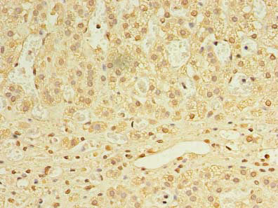Immunohistochemistry of paraffin-embedded human adrenal gland tissue using UTP23 Antibody at dilution of 1:100Rabbit anti-Human UTP23 Polyclonal Antibody