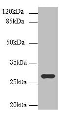 Western blot | All lanes: UTP23 antibody at 7μg/ml + Mouse liver tissue | Secondary | Goat polyclonal to rabbit IgG at 1/10000 dilution | Predicted band size: 29, 17 kDa | Observed band size: 29 kDaRabbit anti-Human UTP23 Polyclonal Antibody