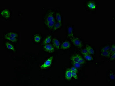 Immunofluorescent analysis of HepG2 cells using SLC25A33 Antibody at dilution of 1:100 and Alexa Fluor 488-congugated AffiniPure Goat Anti-Rabbit IgG(H+L)Rabbit anti-Human SLC25A33 Polyclonal Antibody