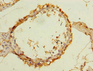 Immunohistochemistry of paraffin-embedded human testis tissue using the antibody at dilution of 1:100Rabbit anti-Human SLC25A33 Polyclonal Antibody