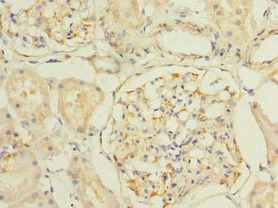 Immunohistochemistry of paraffin-embedded human kidney tissue using SLC25A33 Antibody at dilution of 1:100Rabbit anti-Human SLC25A33 Polyclonal Antibody