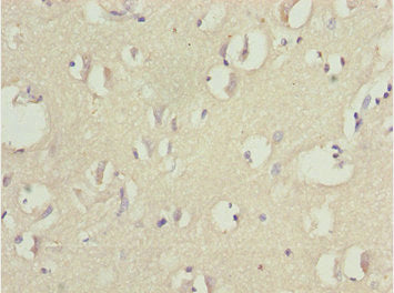 Immunohistochemistry of paraffin-embedded human brain tissue using CNPY3 Antibody at dilution of 1:100Rabbit anti-Human CNPY3 Polyclonal Antibody