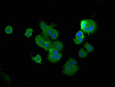 Immunofluorescence staining of MCF-7 cells with TCHP Antibody at 1:400, counter-stained with DAPI. The cells were fixed in 4% formaldehyde, permeabilized using 0.2% Triton X-100 and blocked in 10% normal Goat Serum. The cells were then incubated with the antibody overnight at 4°C. The secondary antibody was Alexa Fluor 488-congugated AffiniPure Goat Anti-Rabbit IgG(H+L).Rabbit anti-Human TCHP Polyclonal Antibody