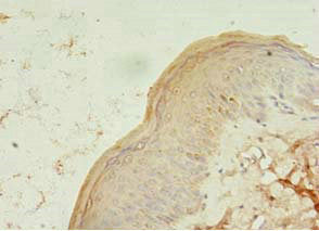 Immunohistochemistry of paraffin-embedded human skin tissue using the antibody at dilution of 1:100Rabbit anti-Human TCHP Polyclonal Antibody