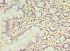 Immunohistochemistry of paraffin-embedded human small intestine tissue using TCHP Antibody at dilution of 1:100Rabbit anti-Human TCHP Polyclonal Antibody