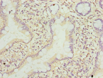 Immunohistochemistry of paraffin-embedded human small intestine tissue using TMEM243 Antibody at dilution of 1:100Rabbit anti-Human TMEM243 Polyclonal Antibody