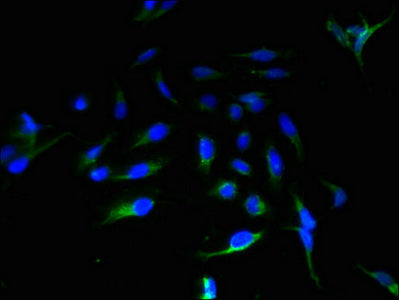 Immunofluorescent analysis of Hela cells using ABHD14A Antibody at dilution of 1:100 and Alexa Fluor 488-congugated AffiniPure Goat Anti-Rabbit IgG(H+L)Rabbit anti-Human ABHD14A Polyclonal Antibody
