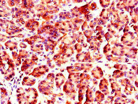 Immunohistochemistry of paraffin-embedded human pancreatic tissue using NUP85 Antibody at dilution of 1:100Rabbit anti-Human NUP85 Polyclonal Antibody