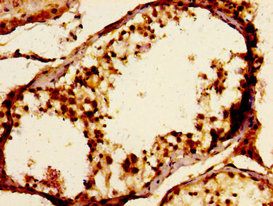 Immunohistochemistry of paraffin-embedded human testis tissue using JAM3 Antibody at dilution of 1:100