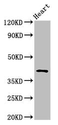 Western Blot | Positive WB detected in: Rat heart tissue | All lanes: JAM3 antibody at 2.5μg/ml | Secondary | Goat polyclonal to rabbit IgG at 1/50000 dilution | Predicted band size: 36, 30 kDa | Observed band size: 45 kDa