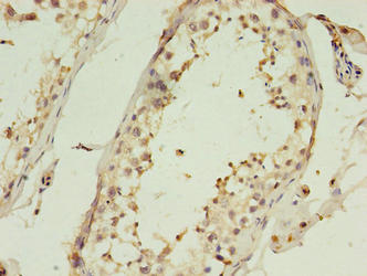 Immunohistochemistry of paraffin-embedded human testis tissue using C1QTNF6 Antibody at dilution of 1:100