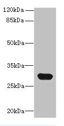 Western blot | All lanes: C1QTNF6 antibody at 8μg/ml + Mouse brain tissue | Secondary | Goat polyclonal to rabbit IgG at 1/10000 dilution | Predicted band size: 29, 31, 18 kDa | Observed band size: 29 kDa