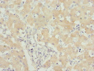 Immunohistochemistry of paraffin-embedded human liver tissue using USP26 Antibody at dilution of 1:100Rabbit anti-Human USP26 Polyclonal Antibody