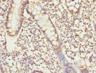 Immunohistochemistry of paraffin-embedded human small intestine tissue using USP26 Antibody at dilution of 1:100Rabbit anti-Human USP26 Polyclonal Antibody