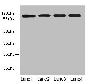 Western blot  | All lanes: USP26 antibody at 5.22µg/ml  | Lane 1: Hela whole cell lysate  | Lane 2: U937 whole cell lysate  | Lane 3: Mouse gonadal tissue  | Lane 4: Mouse liver tissue  | Secondary  | Goat polyclonal to rabbit IgG at 1/10000 dilution  | Predicted band size: 105 kDa  | Observed band size: 105 kDaRabbit anti-Human USP26 Polyclonal Antibody