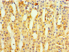 Immunohistochemistry of paraffin-embedded human adrenal gland tissue using MRPL1 Antibody at dilution of 1:100Rabbit anti-Human MRPL1 Polyclonal Antibody
