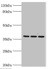 Western blot | All lanes: 39S ribosomal protein L1, mitochondrial antibody at 2μg/ml | Lane 1: Hela whole cell lysate | Lane 2: K562 whole cell lysate | Lane 3: HepG2 whole cell lysate | Secondary | Goat polyclonal to rabbit IgG at 1/10000 dilution | Predicted band size: 39 kDa | Observed band size: 39 kDa