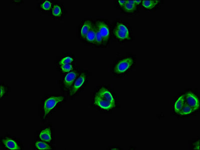 Immunofluorescent analysis of HepG2 cells using PANK2 Antibody at dilution of 1:100 and Alexa Fluor 488-congugated AffiniPure Goat Anti-Rabbit IgG(H+L)Rabbit anti-Human PANK2 Polyclonal Antibody