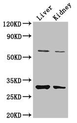 Western Blot | Positive WB detected in: Mouse liver tissue, Mouse kidney tissue | All lanes: PANK2 antibody at 3.4μg/ml | Secondary | Goat polyclonal to rabbit IgG at 1/50000 dilution | Predicted band size: 63, 31, 50, 51 kDa | Observed band size: 63, 31 kDaRabbit anti-Human PANK2 Polyclonal Antibody
