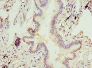 Immunohistochemistry of paraffin-embedded human lung tissue using CHIA Antibody at dilution of 1:100Rabbit anti-Human CHIA Polyclonal Antibody