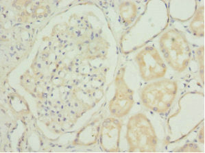 Immunohistochemistry of paraffin-embedded human kidney tissue using CHIA Antibody at dilution of 1:100Rabbit anti-Human CHIA Polyclonal Antibody
