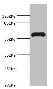 Western blot | All lanes: CHIA antibody at 0.74μg/ml + Mouse stomach tissue | Secondary | Goat polyclonal to rabbit IgG at 1/10000 dilution | Predicted band size: 53, 41, 34 kDa | Observed band size: 53 kDaRabbit anti-Human CHIA Polyclonal Antibody
