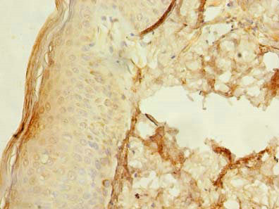 Immunohistochemistry of paraffin-embedded human skin tissue using UBXN6 Antibody at dilution of 1:100Rabbit anti-Human UBXN6 Polyclonal Antibody