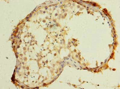 Immunohistochemistry of paraffin-embedded human testis tissue using UBXN6 Antibody at dilution of 1:100Rabbit anti-Human UBXN6 Polyclonal Antibody