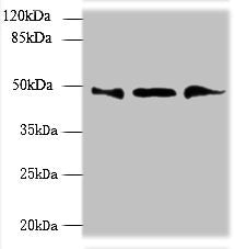 Western blot | All lanes: UBXN6 antibody at 1.2μg/ml | Lane 1: PC-3 whole cell lysate | Lane 2: Hela whole cell lysate | Lane 3: Mouse kidney tissue | Secondary | Goat polyclonal to rabbit IgG at 1/10000 dilution | Predicted band size: 50, 44 kDa | Observed band size: 50 kDaRabbit anti-Human UBXN6 Polyclonal Antibody
