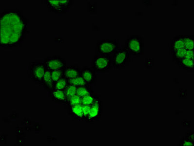 Immunofluorescent analysis of PC-3 cells using FOXQ1 Antibody at dilution of 1:100 and Alexa Fluor 488-congugated AffiniPure Goat Anti-Rabbit IgG(H+L)Rabbit anti-Human FOXQ1 Polyclonal Antibody