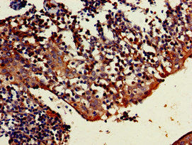 Immunohistochemistry of paraffin-embedded human tonsil tissue using TRIM5 Antibody at dilution of 1:100Rabbit anti-Human TRIM5 Polyclonal Antibody