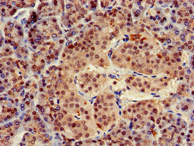 Immunohistochemistry of paraffin-embedded human pancreatic tissue using TRIM5 Antibody at dilution of 1:100Rabbit anti-Human TRIM5 Polyclonal Antibody
