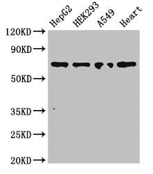 Western Blot | Positive WB detected in: HepG2 whole cell lysate, HEK293 whole cell lysate, A549 whole cell lysate, Mouse heart tissue | All lanes: TRIM5 antibody at 3μg/ml | Secondary | Goat polyclonal to rabbit IgG at 1/50000 dilution | Predicted band size: 57, 47, 41, 38, 32, 30 kDa | Observed band size: 70 kDaRabbit anti-Human TRIM5 Polyclonal Antibody