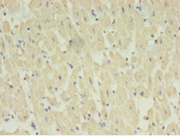 Immunohistochemistry of paraffin-embedded human heart tissue using STRADB Antibody at dilution of 1:100Rabbit anti-Human STRADB Polyclonal Antibody